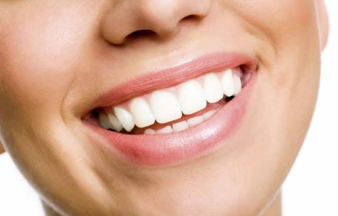 Bright, whitened smile
